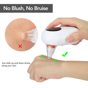 Blackhead Remover